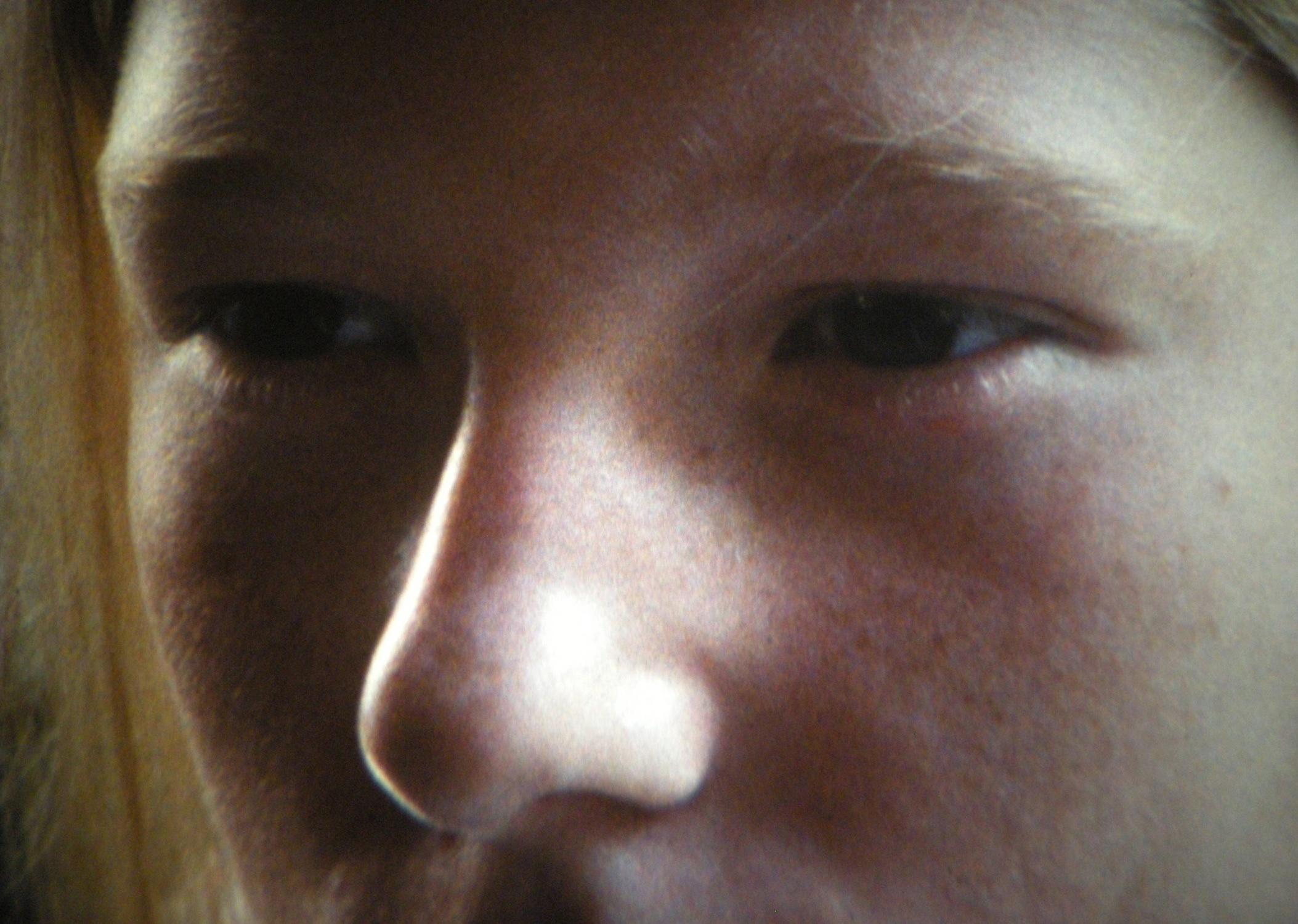 A close-up photograph shows the eyes and nose of a young light-skinned person looking off to the right.